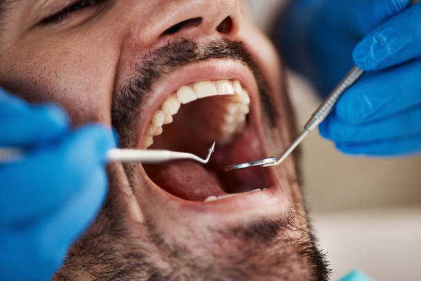 Best Urgent Care for Lost Fillings or Crowns in Atoka, NM